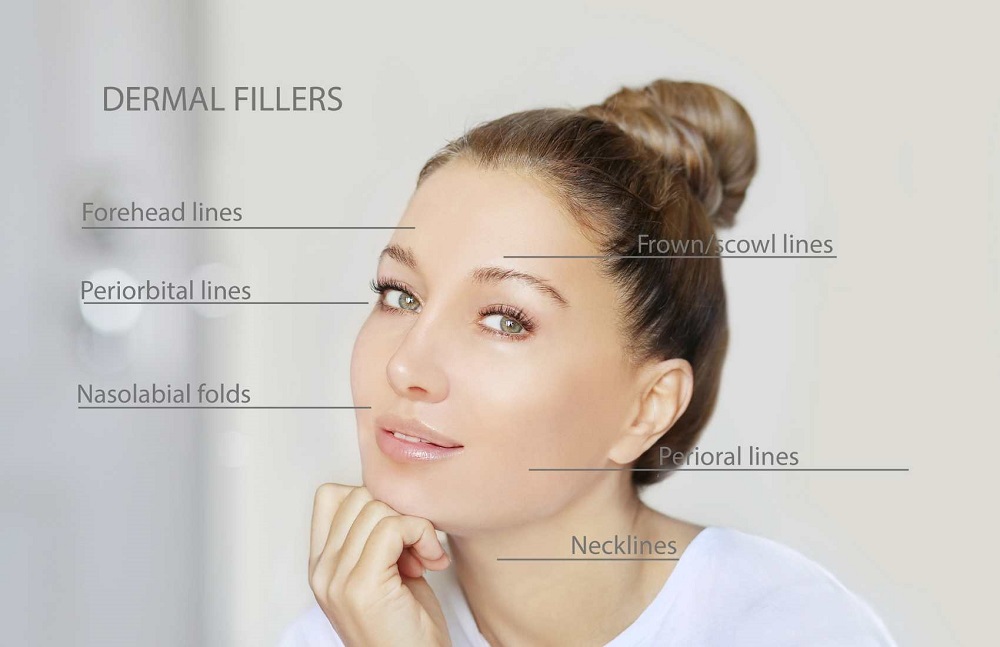 10 Things to Know before Trying Dermal Fillers